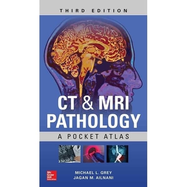 Bệnh lý học CT & MRI – Atlas bỏ túi